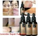 Lavender Repair Essence Stretch Marks Scar Removal Skin